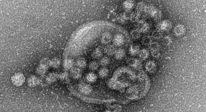Norovirus auf Kreuzfahrt  Erreger kommt meist von Passagieren